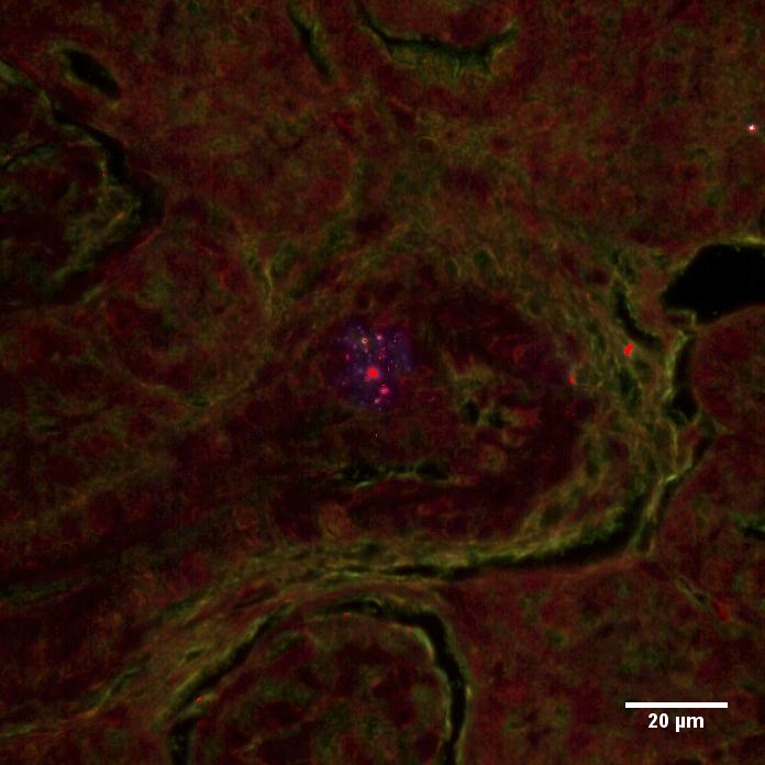 Generational Passage of Micro-Nano-Plastic Particles